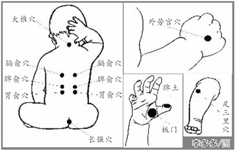 Image de points d'acupuncture pour enfants